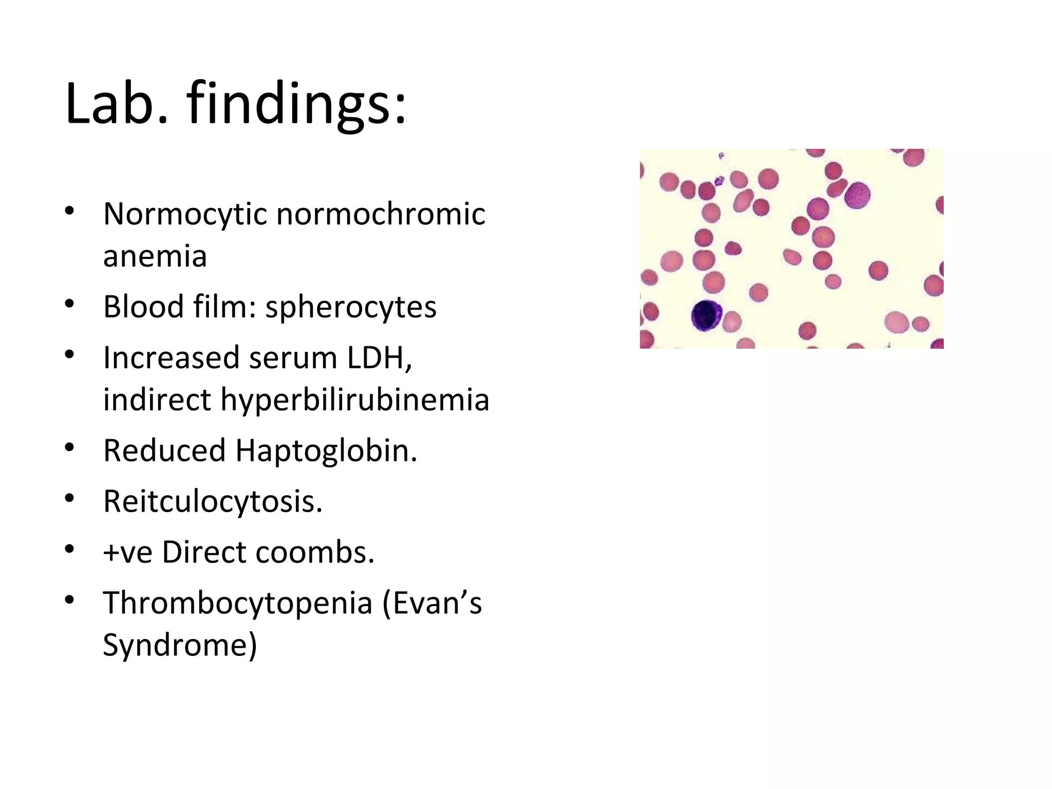 Lab. findings:
• Normocytic normochromic
anemia
• Blood film: spherocytes
• Increased serum LDH,
indirect hyperbilirubinemia
• Reduced Haptoglobin.
• Reitculocytosis.
• +ve Direct coombs.
• Thrombocytopenia (Evan’s
Syndrome)