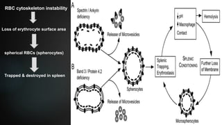 Spleen Rbc Hemolytic anemia | PPTX