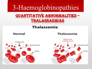 3-Haemoglobinopathies
 