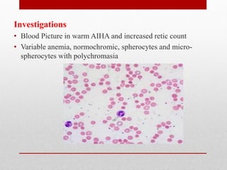 Investigations
• Blood Picture in warm AIHA and increased retic count
• Variable anemia, normochromic, spherocytes and micro-
spherocytes with polychromasia
 