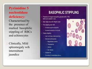 Pyrimidine 5
nucleotidase
deficiency:
Characterised by
the presence of
marked basophilic
stippling of RBCs
and echinocytes
Clinically, Mild
spleomegaly wih
intermittent
jaundice
 