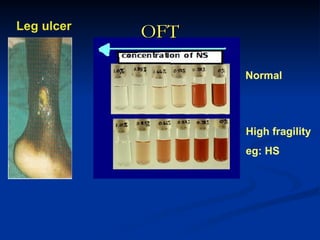 OFT
OFT
Normal
High fragility
eg: HS
Leg ulcer
 