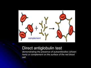 Hemolytic Anemia Classification - By Thejus K. Thilak | PPTX