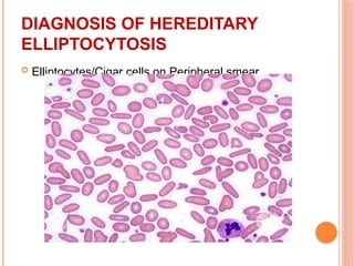 Approach to Hemolytic Anemias in children | PPTX