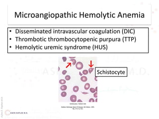 AşkınK.KaplanM.D.
Microangiopathic Hemolytic Anemia
• Disseminated intravascular coagulation (DIC)
• Thrombotic thrombocytopenic purpura (TTP)
• Hemolytic uremic syndrome (HUS)
Schistocyte
 