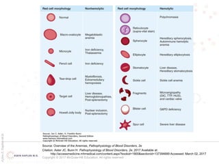 AşkınK.KaplanM.D.
Source: Overview of the Anemias, Pathophysiology of Blood Disorders, 2e
Citation: Aster JC, Bunn H. Pathophysiology of Blood Disorders, 2e; 2017 Available at:
http://accessmedicine.mhmedical.com/content.aspx?bookid=1900&sectionid=137394689 Accessed: March 02, 2017
Copyright © 2017 McGraw-Hill Education. All rights reserved
 