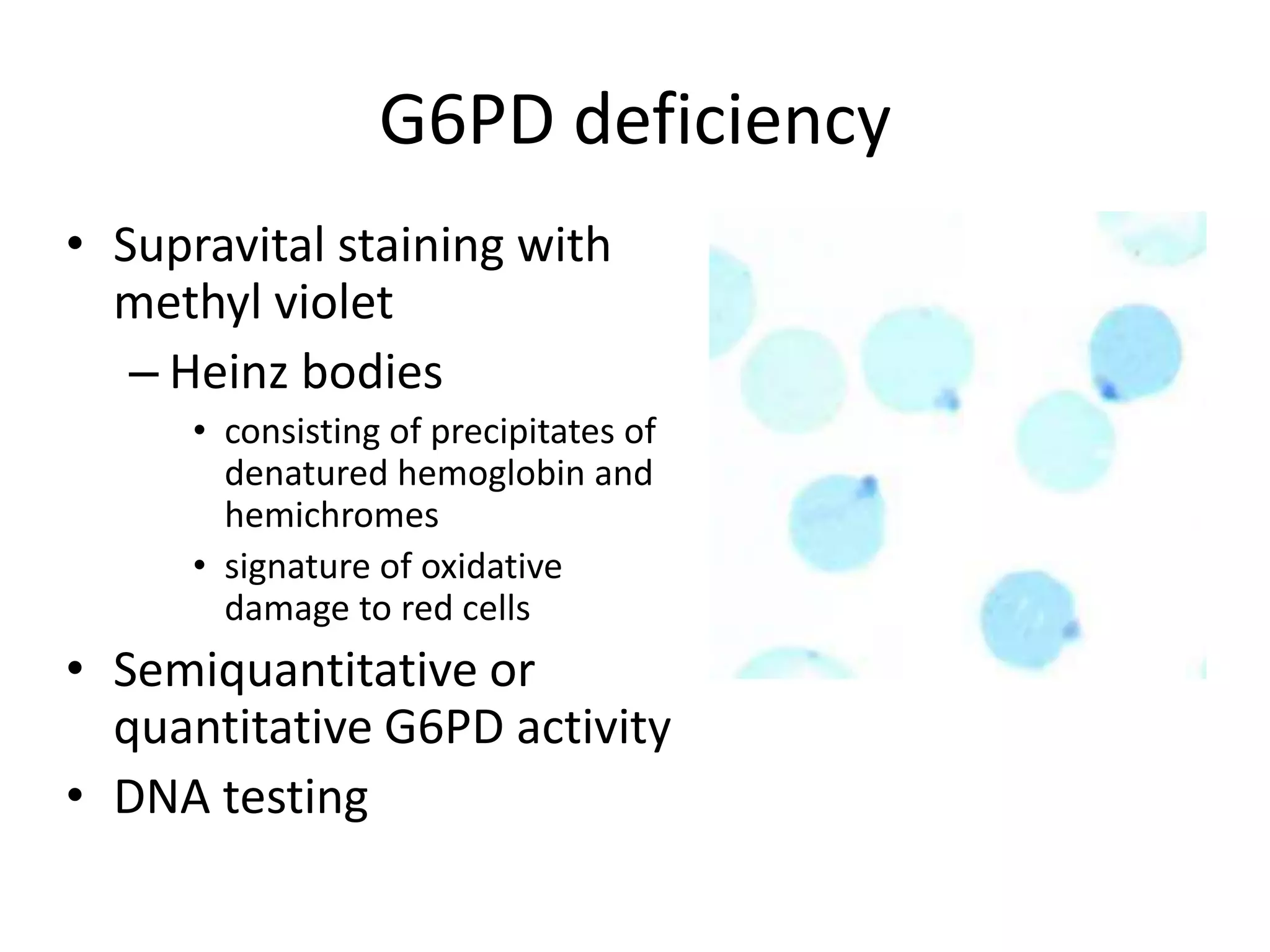 Hemolytic anemia case | PPTX