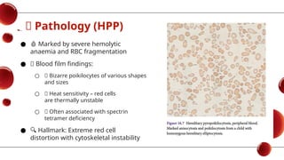 Approach to Hemolytic anemia cubeMD.pptx