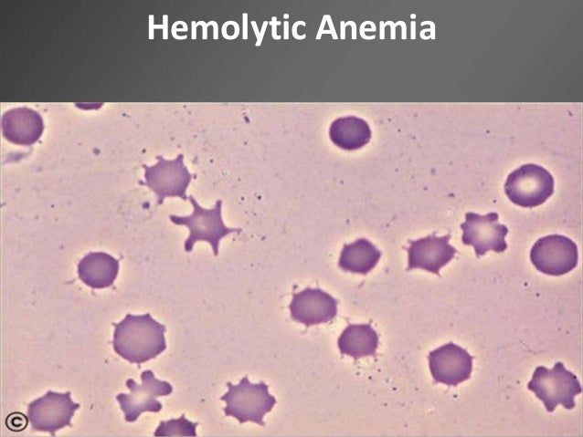 Hemolytic anemia I