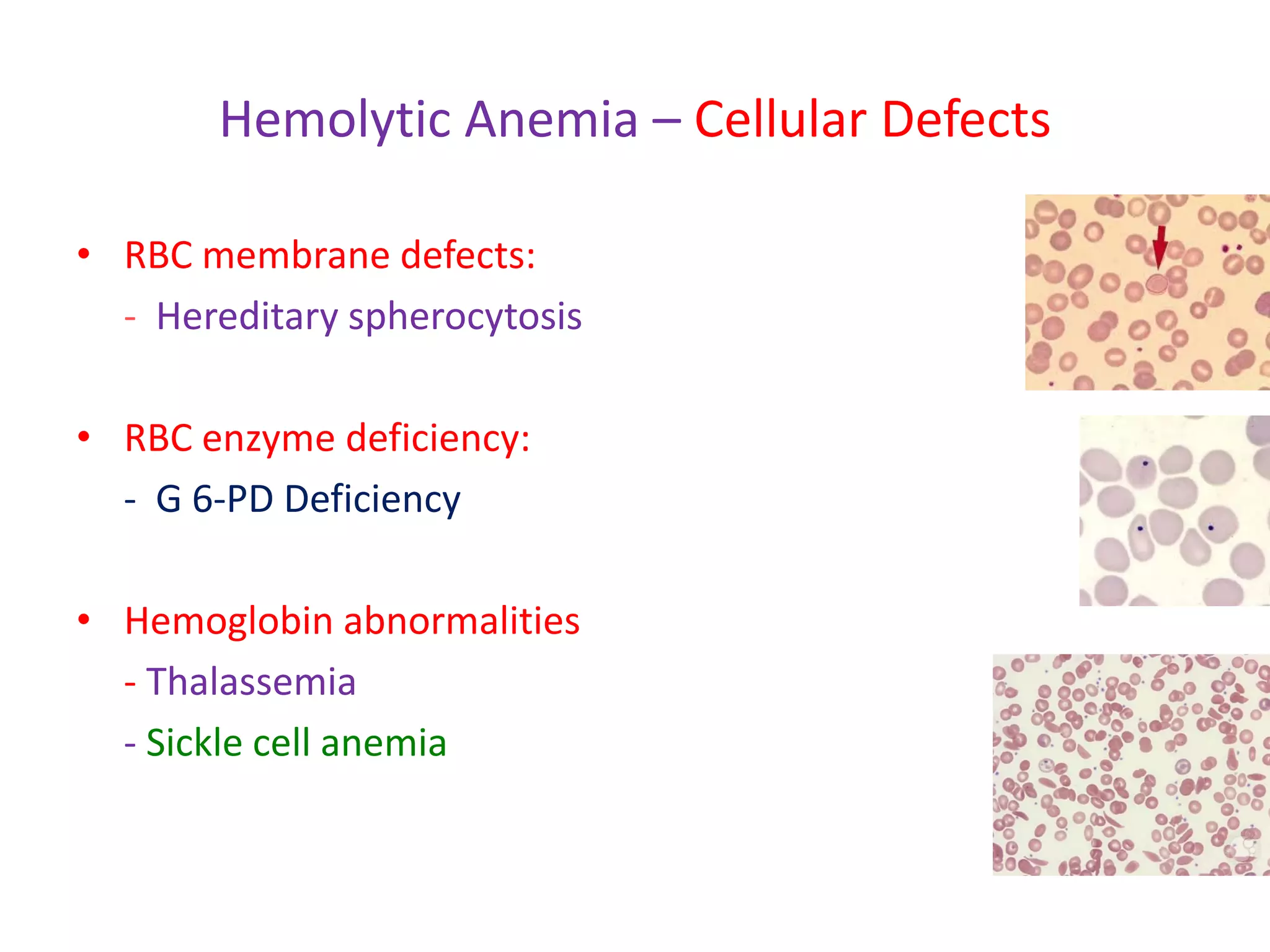 Membrane Deficiency Hemolytic anemia in children 2021 | PDF