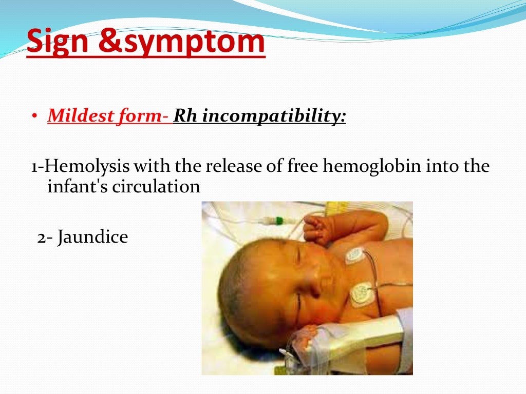Hemolytic disease of newborn Lecture Final Year MBBS