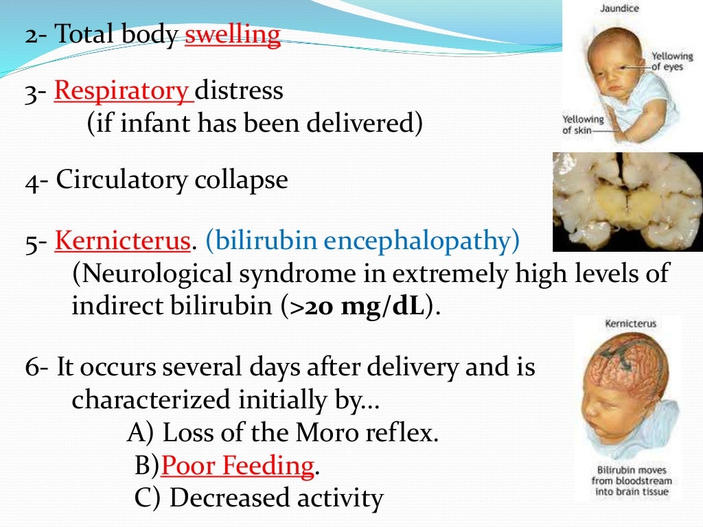 Hemolytic disease of newborn Lecture Final Year MBBS