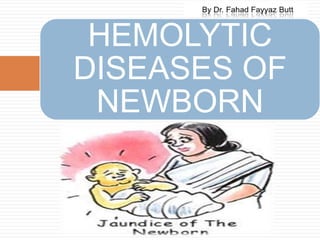 HEMOLYTIC
DISEASES OF
 NEWBORN
 