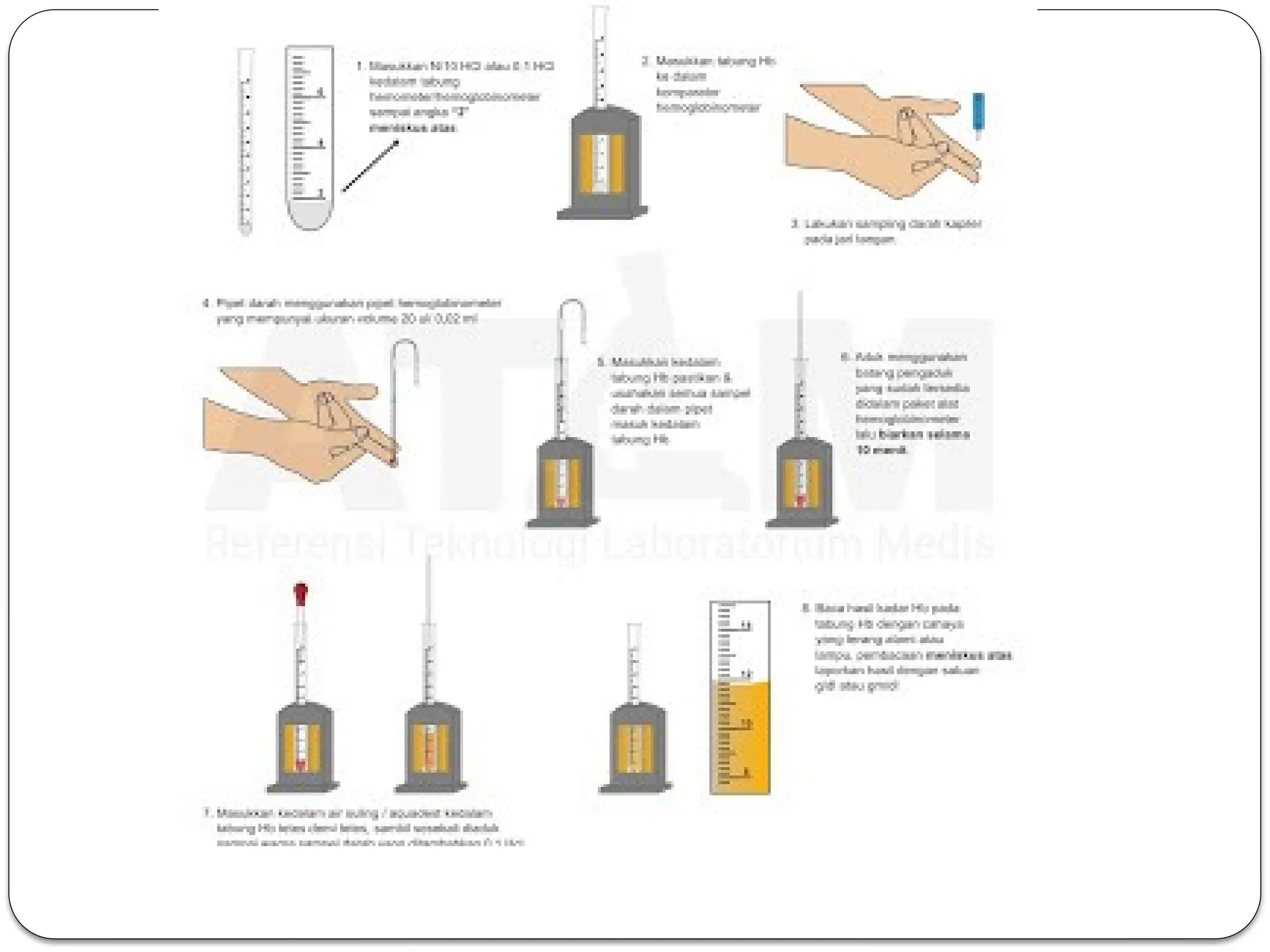 Hemometer Assistant penjelasan alat hemometer sahli untuk mngkur hemoglobin.pptx