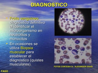DIAGNOSTICO

  • Frotis sanguíneo:
       diagnóstico definitivo
       al identificar el
       microorganismo en
       neutrófilos y
       monocitos
  •    En ocasiones se
       utiliza Biopsia
       muscular para
       establecer el
       diagnóstico (quistes
       musculares).             FOTOS CORTESIA Dr. ALEXANDER DAVID

FAGO
 