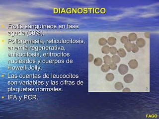 DIAGNOSTICO

• Frotis sanguíneos en fase
    aguda (50%).
•   Policromasia, reticulocitosis,
    anemia regenerativa,
    anisocitosis, eritrocitos
    nucleados y cuerpos de
    Howell-Jolly.
•   Las cuentas de leucocitos
    son variables y las cifras de
    plaquetas normales.
•   IFA y PCR.

                                     FAGO
 