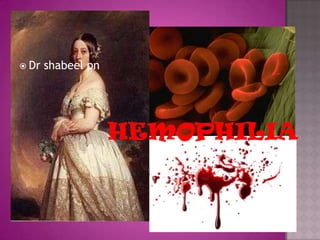 hemophilia Dr shabeelpn 