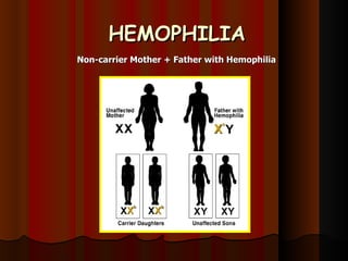 HEMOPHILIA Non-carrier Mother + Father with Hemophilia 