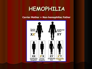 HEMOPHILIA Carrier Mother + Non-hemophiliac Father   