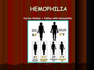 HEMOPHILIA Carrier Mother + Father with Hemophilia 
