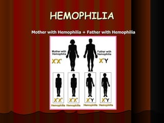 HEMOPHILIA Mother with Hemophilia + Father with Hemophilia 