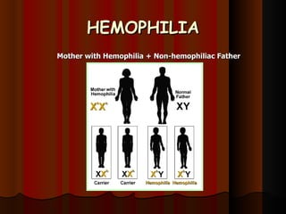 HEMOPHILIA Mother with Hemophilia + Non-hemophiliac Father 