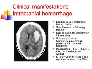 Clinical manifestations
Intracranial hemorrhage
 Leading cause of death of
hemophiliacs
 Spontaneous or following
trauma
 May be subdural, epidural or
intracerebral
 Suspect always in
hemophilic patient that
presents with unusual
headache
 If suspected- FIRST TREAT,
then pursue diagnostic
workup
 LP only when fVIII has been
replaced to more than 50%
 