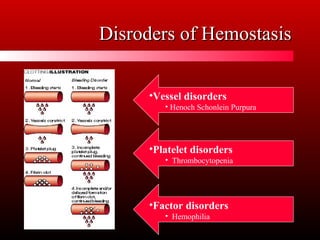 Disroders of HemostasisDisroders of Hemostasis
•Vessel disorders
• Henoch Schonlein Purpura
•Platelet disorders
• Thrombocytopenia
•Factor disorders
• Hemophilia
 