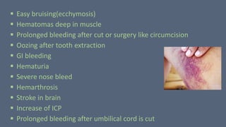  Easy bruising(ecchymosis)
 Hematomas deep in muscle
 Prolonged bleeding after cut or surgery like circumcision
 Oozing after tooth extraction
 GI bleeding
 Hematuria
 Severe nose bleed
 Hemarthrosis
 Stroke in brain
 Increase of ICP
 Prolonged bleeding after umbilical cord is cut
 