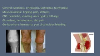 General: weakness, orthostasis, tachypnea, tachycardia
Musculoskeletal: tingling, pain, stiffness
CNS: headache, vomiting, neck rigidity, lethargy
GI: melena, hematemesis, abd pain
Genitourinary: hematuria, post circumcision bleeding
 