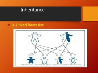 Inheritance
 X-Linked Recessive
 