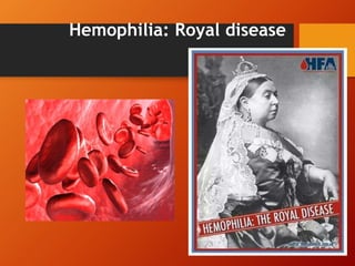 Hemophilia: Royal disease
 