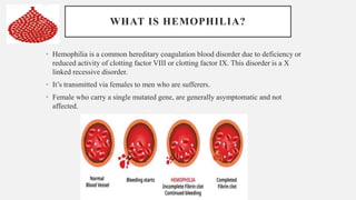 WHAT IS HEMOPHILIA?
• Hemophilia is a common hereditary coagulation blood disorder due to deficiency or
reduced activity of clotting factor VIII or clotting factor IX. This disorder is a X
linked recessive disorder.
• It’s transmitted via females to men who are sufferers.
• Female who carry a single mutated gene, are generally asymptomatic and not
affected.
 