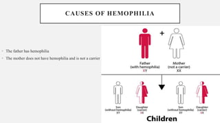 CAUSES OF HEMOPHILIA
• The father has hemophilia
• The mother does not have hemophilia and is not a carrier
 