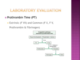  Prothrombin Time (PT)
 Extrinsic (F VII) and Common (F X, F V,
Prothrombin & Fibrinogen)
 