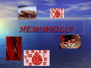 HEMOPHILIA 