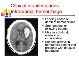 Clinical manifestations
Intracranial hemorrhage
 Leading cause of
death of hemophiliacs
 Spontaneous or
following trauma
 May be subdural,
epidural or
intracerebral
 Suspect always in
hemophilic patient that
presents with unusual
headache
 