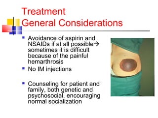 Treatment
General Considerations
 Avoidance of aspirin and
NSAIDs if at all possible
sometimes it is difficult
because of the painful
hemarthrosis
 No IM injections
 Counseling for patient and
family, both genetic and
psychosocial, encouraging
normal socialization
 