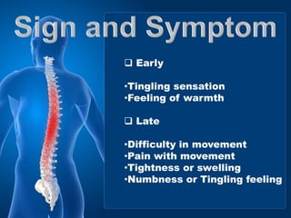  Early
•Tingling sensation
•Feeling of warmth
 Late
•Difficulty in movement
•Pain with movement
•Tightness or swelling
•Numbness or Tingling feeling
 