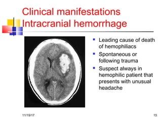 Clinical manifestations
Intracranial hemorrhage
 Leading cause of death
of hemophiliacs
 Spontaneous or
following trauma
 Suspect always in
hemophilic patient that
presents with unusual
headache
11/19/17 15
 