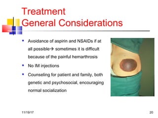 Treatment
General Considerations
 Avoidance of aspirin and NSAIDs if at
all possible sometimes it is difficult
because of the painful hemarthrosis
 No IM injections
 Counseling for patient and family, both
genetic and psychosocial, encouraging
normal socialization
11/19/17 20
 