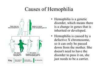 Causes of Hemophilia
●

●

Hemophilia is a genetic
disorder, which means there
is a change in genes that is
inherited or developed.
Hemophilia is caused by a
defective X chromosome,
so it can only be passed
down from the mother. She
doesn't need to have the
disorder to pass it on, she
just needs to be a carrier.

 