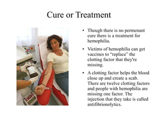 Cure or Treatment
●

●

●

Though there is no permenant
cure there is a treatment for
hemophilia.
Victims of hemophilia can get
vaccines to “replace” the
clotting factor that they're
missing.
A clotting factor helps the blood
close up and create a scab.
There are twelve clotting factors
and people with hemophilia are
missing one factor. The
injection that they take is called
antifibrionolytics.

 