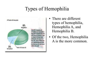 Types of Hemophilia
●

●

There are different
types of hemophilia,
Hemophilia A, and
Hemophilia B.
Of the two, Hemophilia
A is the more common.

 