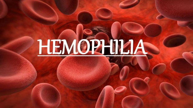 Hemophilia Ppt 