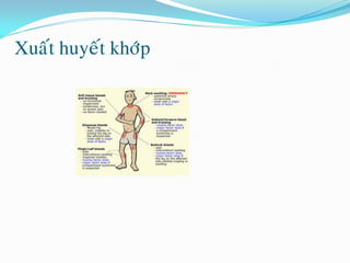 Xuaát huyeát khôùp
 