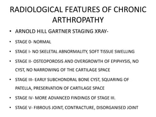 Hemophilic arthropathy PPT