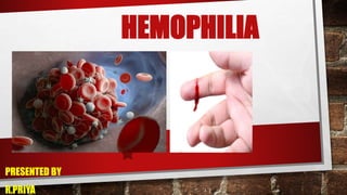 HEMOPHILIA
PRESENTED BY
R.PRIYA
 