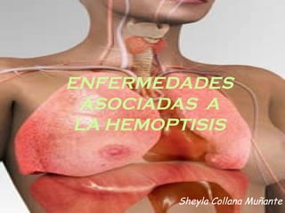 ENFERMEDADES ASOCIADAS  A LA HEMOPTISIS Sheyla Collana Muñante 