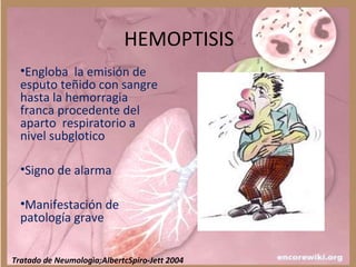HEMOPTISIS
•Engloba la emisión de
esputo teñido con sangre
hasta la hemorragia
franca procedente del
aparto respiratorio a
nivel subglotico
•Signo de alarma
•Manifestación de
patología grave
Tratado de Neumologìa;AlbertcSpiro-Jett 2004
 